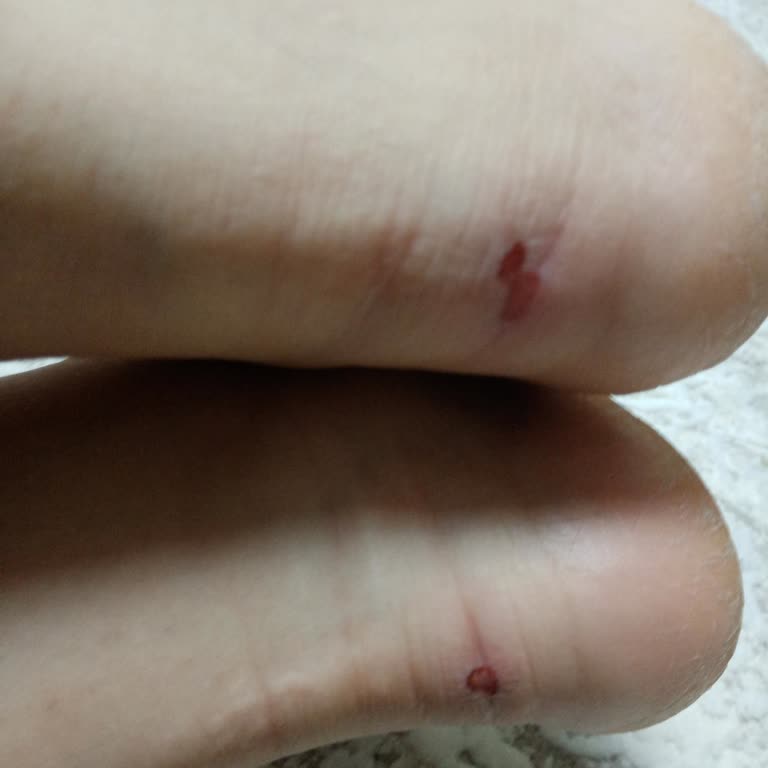 Aldığım Ayakkabı Ayağımı Yaraladı, Değişim Talebim Reddedildi