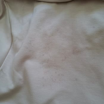 İlk Yıkamada Deforme Olan Tunik Ve Ulaşılamayan Müşteri Hizmetleri