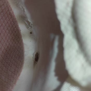 Aldığım Ayakkabıda Yırtılma Ve Kararma, İade Talebim Reddedildi!