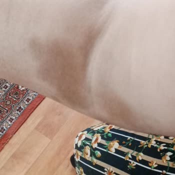 Hamilelikte Yapılan Yanlış Serum Uygulaması Sonucu Kolumda Kalıcı İz Oluştu