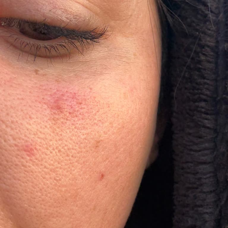 Ase Estetik Güzellik Vaat Ettikleri Hiçbir Şey Gerçekleşmedi!