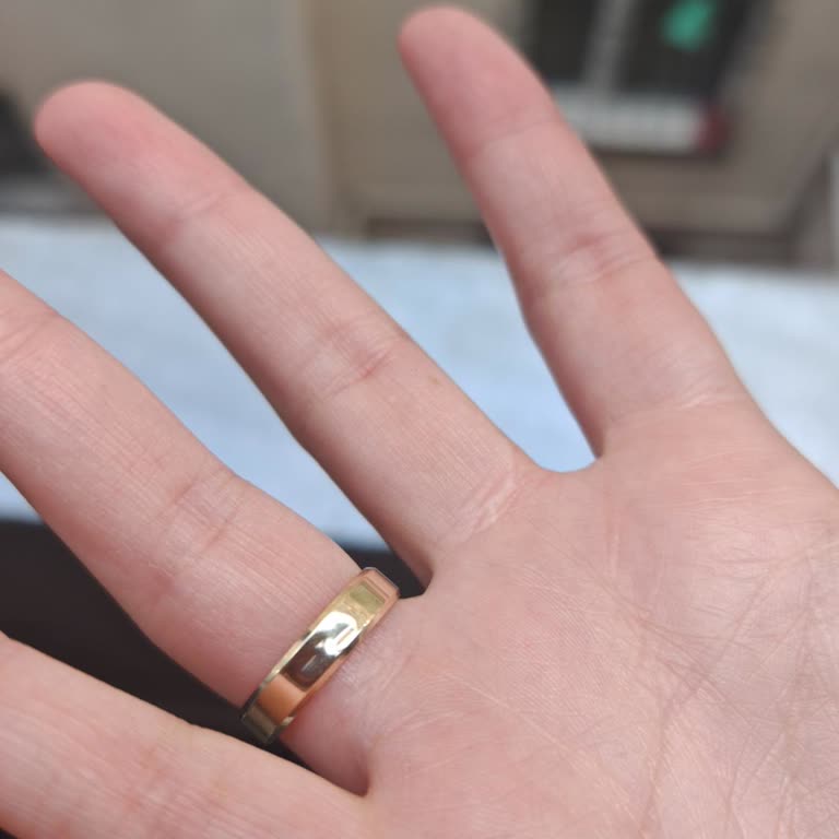 Yeni Alınan Alyans İkinci Gününde Ezildi Mağduriyet Yaşadım