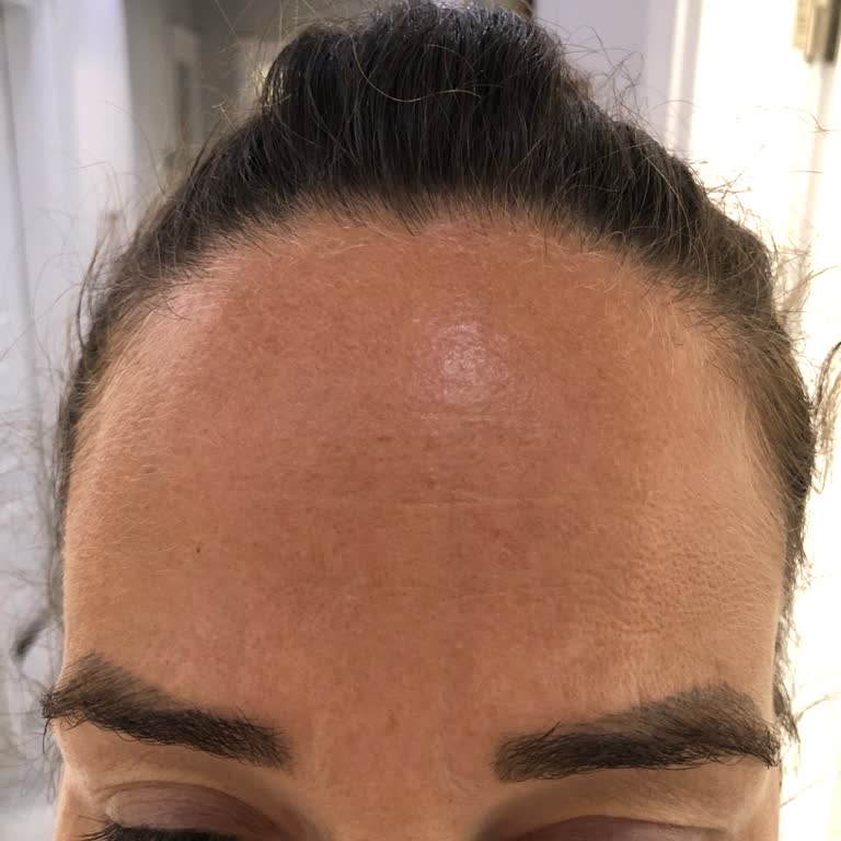 Eyüp Stüdyo (Antalya)'da Yaptırdığım İşlemden Memnun Kalmadım