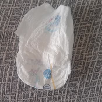 Molfix Bebek Bezinde Üretim Hatası Ve İade Talebi