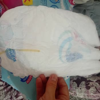 Molfix Bebek Bezinde Üretim Hatası Ve İade Talebi