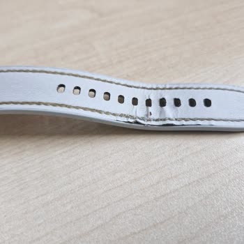 Samsung Watch 6 Kordonu Kısa Sürede Aşındı, Servis Çözüm Sunmadı