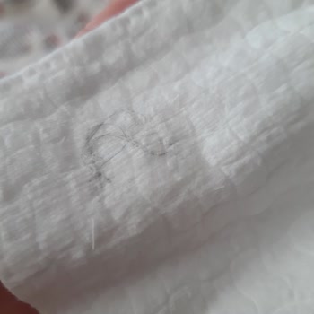 Sipariş Edilen Pamukta Saç Kılı Çıkması Ve Hijyen Sorunu