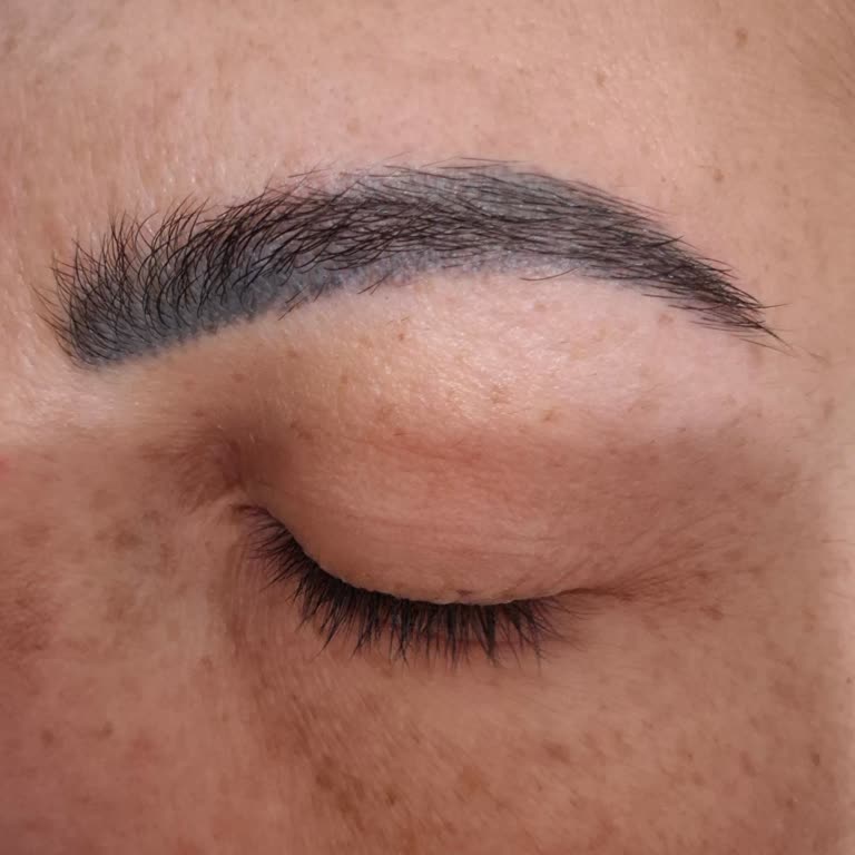 Microblading İşlemi Sonrası Kalıcı Kaş Sorunu Ve Çözüm Beklentisi