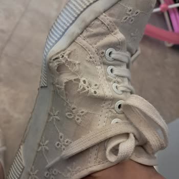 Ayakkabıda Yırtılma Ve Müşteri Hizmetlerine Ulaşılamıyor