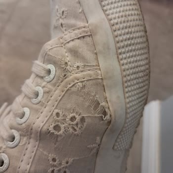 Ayakkabıda Yırtılma Ve Müşteri Hizmetlerine Ulaşılamıyor