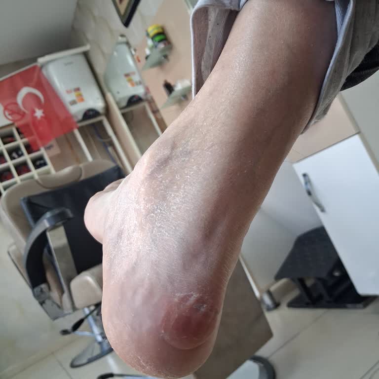 FLO Mağazası İade Talebimi Gerekçesiz Reddetti, Mağdur Oldum