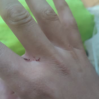 Kamil Koç Otobüsünde Darp Edildim, Firma Çözüm Sunmuyor