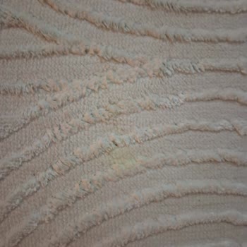 Vivense Halı Kolay Temizlenmiyor, Müşteri Hizmetleri İlgisiz Kaldı