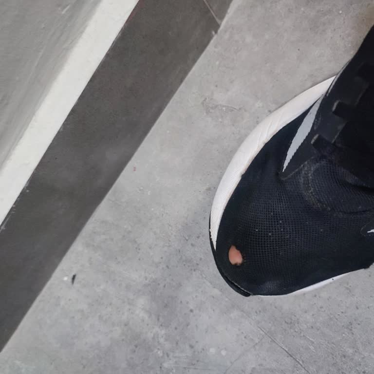 Kısa Sürede Deforme Olan Adidas Ayakkabının Değişim Talebimin Reddedilmesi