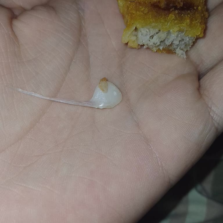 Dardanel Fish Finger Ürününde Büyük Kılçık Tehlikesi: Sağlığım Tehlikeye Girdi