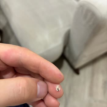 Aldığım Ekmekte Böcek Çıkması Ve Hijyen Sorunu