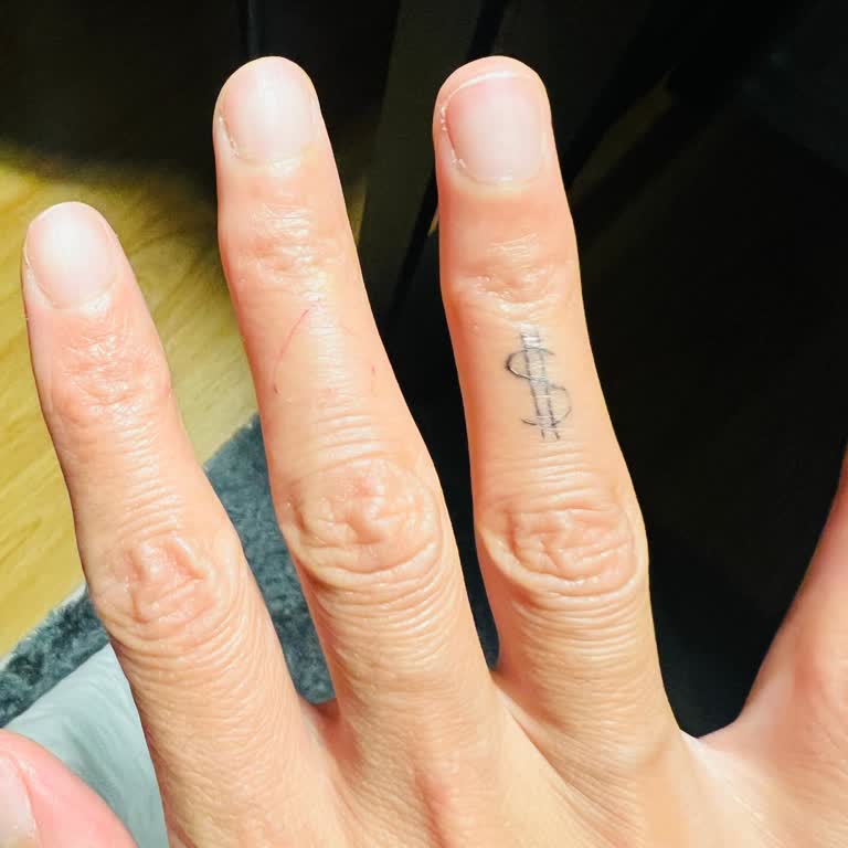 Kadıköy Z28 Şubesinde Yapılan Dövmeler Hızla Silindi, Mağduriyetim Giderilmedi