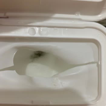 Aldığım Islak Mendil Paketinden Kirli Ürünler Çıktı, Mağduriyet Yaşadım