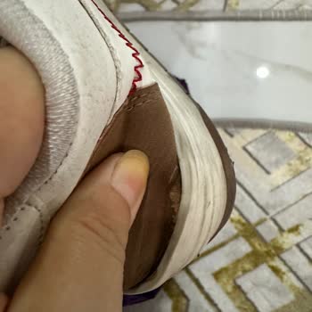 Kısa Sürede Deforme Olan Ayakkabıma Red Cevabı!