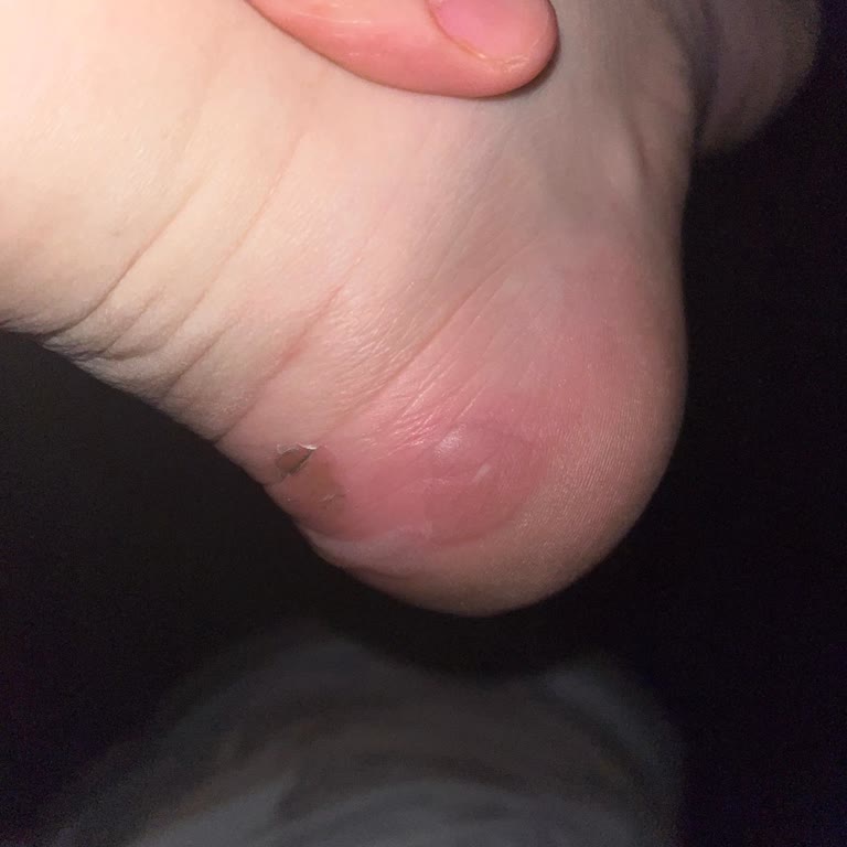 Greyder Botun Sert Topuğu Ayaklarımı Kesti Mağaza Çözüm Sunmadı