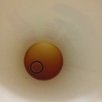 Burger King Siparişimde Yabancı Madde Ve Kalitesiz Ürün Sorunu