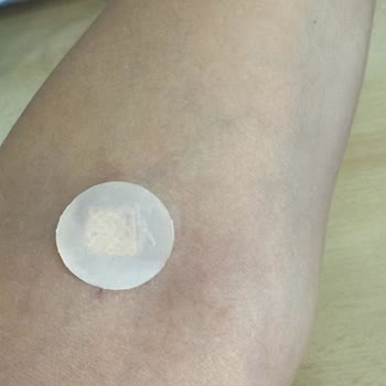 Acil Serviste Hemşire Davranışı Nedeniyle Yaşadığım Stres Ve Mağduriyet