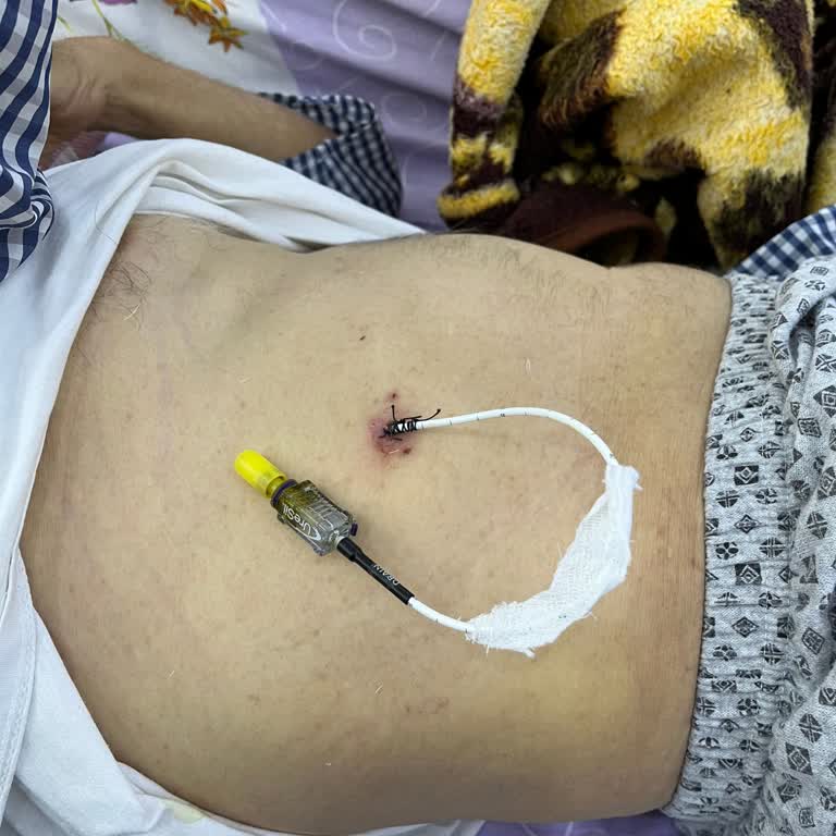 Anlaşmaya Rağmen Ek Ücret Talebi Ve Yarım Kalan Tedaviyle Mağduriyet