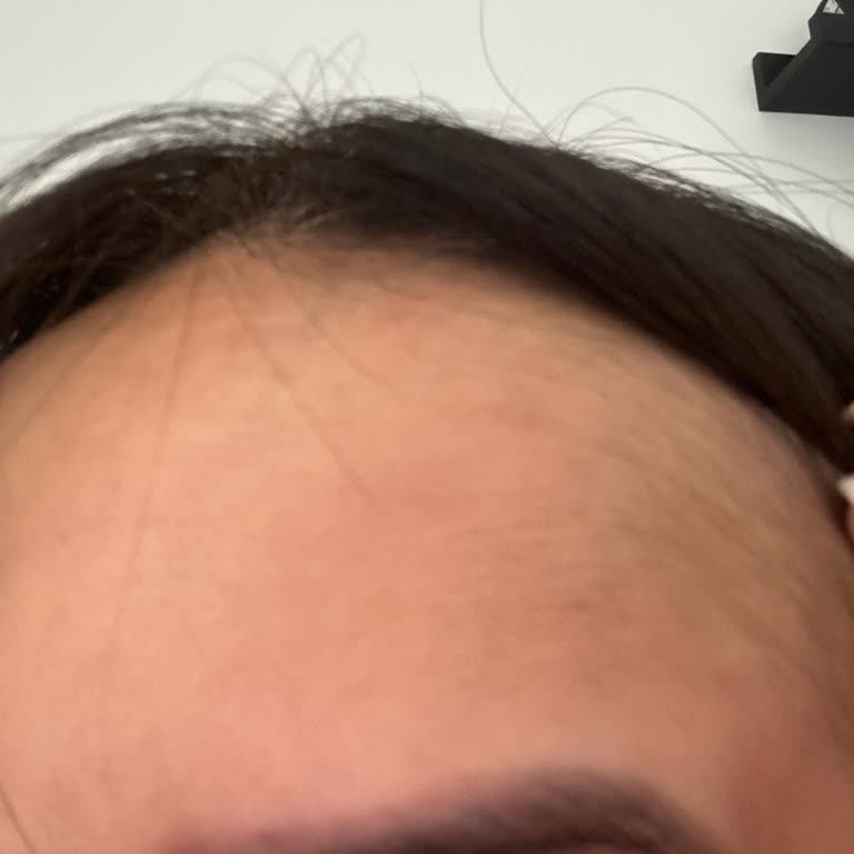 Yanlış Uygulama Sonucu Kalıcı Zarar Ve İlgisiz Hizmet