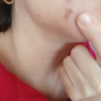 Faturasız Ve Onaysız Ürün: Benson Cildimi Mahvetti!