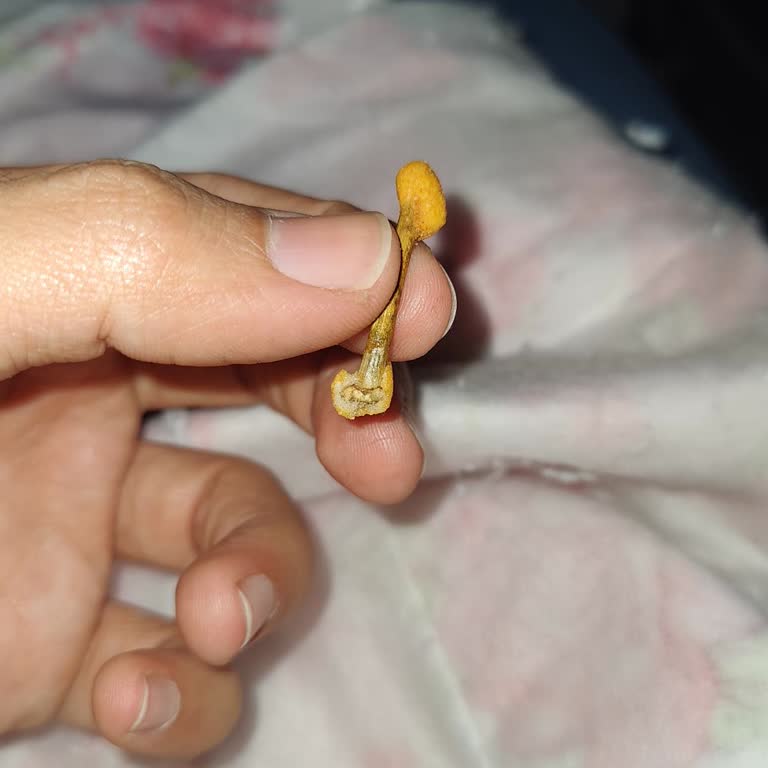 Cips Fıstık Paketinde Yabancı Cisim Buldum, Açıklama Bekliyorum