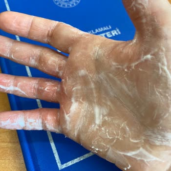 Stanley Termosun Kapağı Patladı Elim Yandı