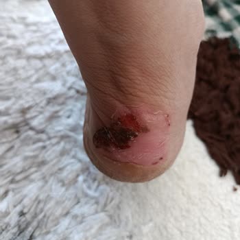 Kullanılmadan Anlaşılamayan Ayakkabı Kusuru Ve İade Reddi Mağduriyeti