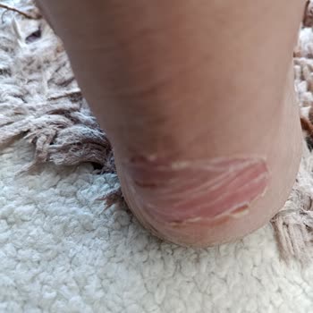 Kullanılmadan Anlaşılamayan Ayakkabı Kusuru Ve İade Reddi Mağduriyeti