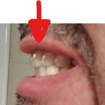 Melsadent Ağız Ve Diş Sağlığı Polikliniği Hüsranı!