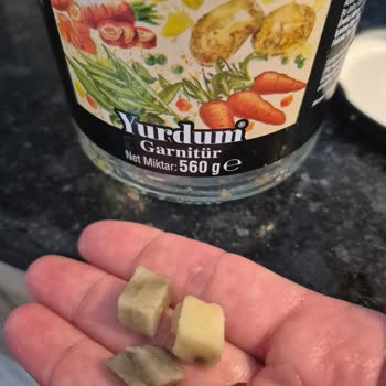 BİM’den Aldığım Garnitürler Bozuk Çıktı, Sağlığım Tehlikeye Girdi