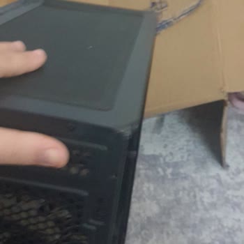 Servis Sonrası Hasarlı Kasa Ve Eksik Parça Sorunu