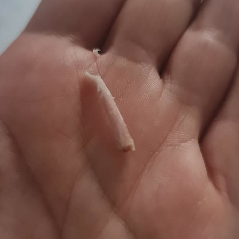 Burgerin İçinde Kemik Çıkması Ve Restoranın İletişimsizliği Mağduriyet Yarattı