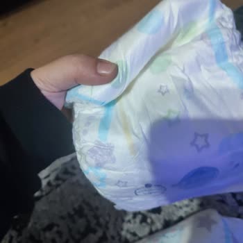 Molfix Bebek Bezlerinde Üretim Hatası Ve Kullanılamaz Ürünler Mağduriyet Yaşattı