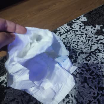 Molfix Bebek Bezlerinde Üretim Hatası Ve Kullanılamaz Ürünler Mağduriyet Yaşattı