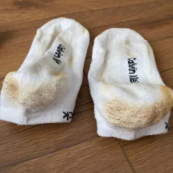 Derimoddan Alınan Ayakkabının İlk Giyimde Boya Vermesi Ve İade Reddi