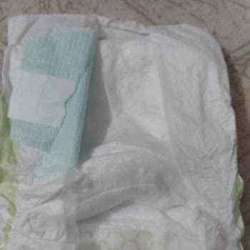 Bebek Bezinde Ciddi Üretim Hatası: Eksik Ve Yırtık Yan Bantlar