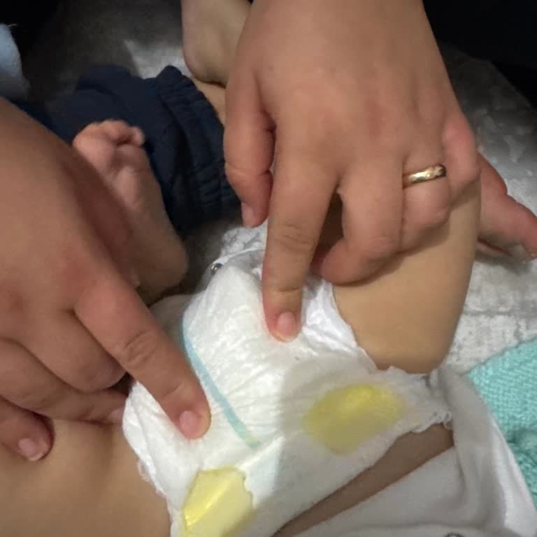 Aldığım Bebek Bezlerinde Sızdırma Problemi Ve Mağduriyet