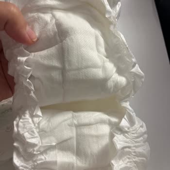 Sleepy Bio Natural Bebek Bezinde Ciddi Kalite Sorunu ve Sızdırma Problemi Yaşadım