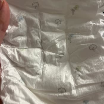 Sleepy Bio Natural Bebek Bezinde Ciddi Kalite Sorunu ve Sızdırma Problemi Yaşadım