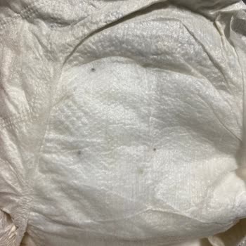 Bebek Bezinde Karşılaşılan Siyah Madde Hijyen Endişesi Yarattı