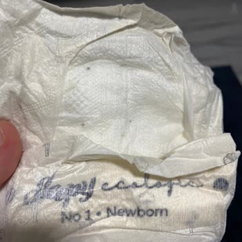 Bebek Bezinde Karşılaşılan Siyah Madde Hijyen Endişesi Yarattı