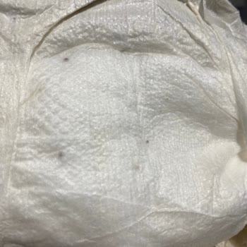 Bebek Bezinde Karşılaşılan Siyah Madde Hijyen Endişesi Yarattı