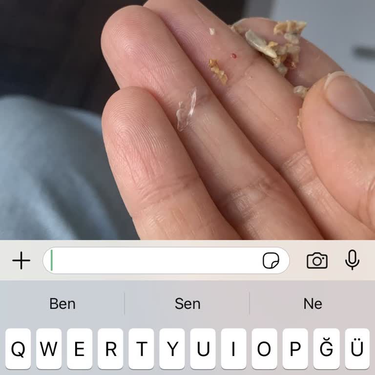 Granola İçinden Cam Parçası Çıktı, Fellas'tan Yetersiz Yanıt!