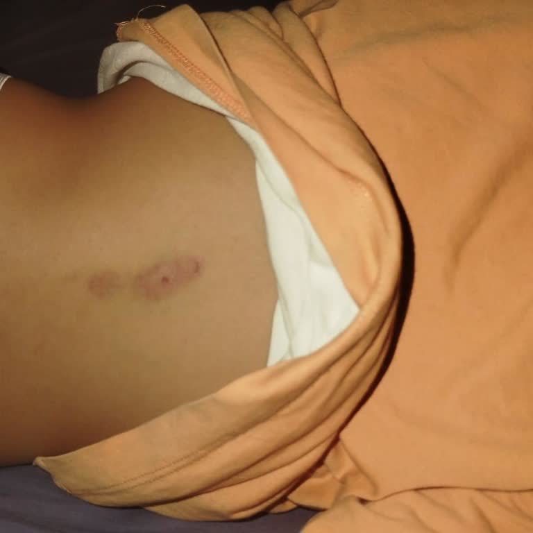 Yeditepe Sports Yaz Okulunda Yetersiz Oryantasyon Ve Güvenlik Sorunları Çocuğumu Olumsuz Etkiledi