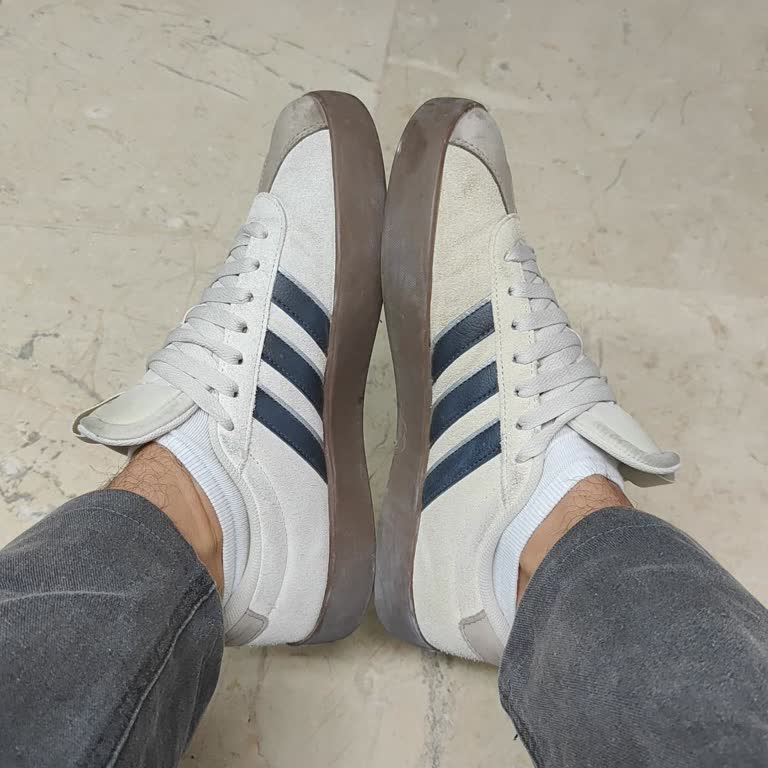 Kısa Sürede Renk Değişen Ayakkabı İçin İnceleme Sonucu Ve Mağaza Yaklaşımından Memnun Değilim